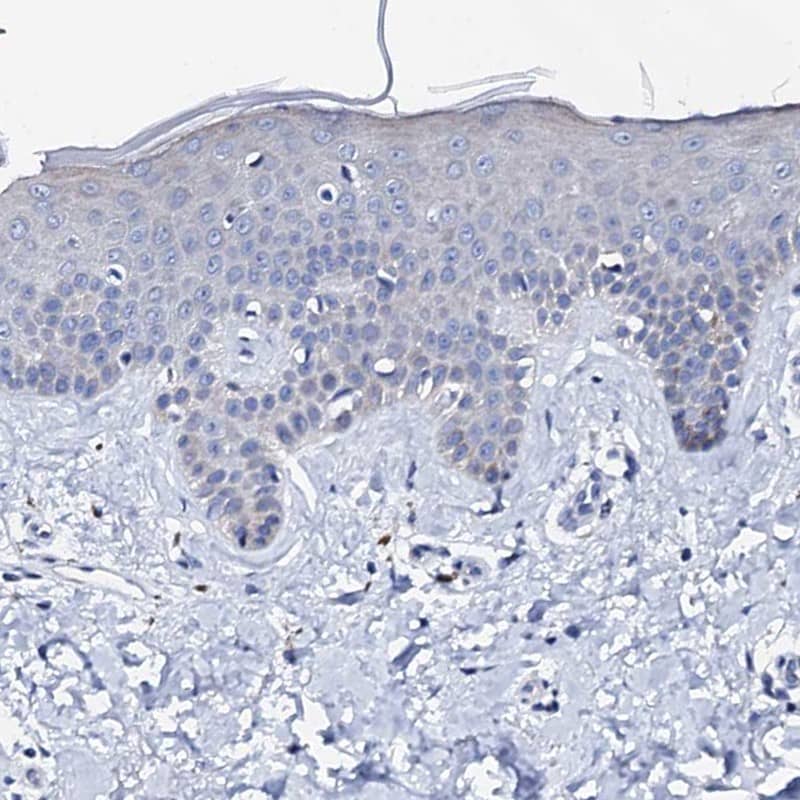 Triadin Antibody - BSA Free Immunohistochemistry-Paraffin: Triadin Antibody [NBP1-87417]