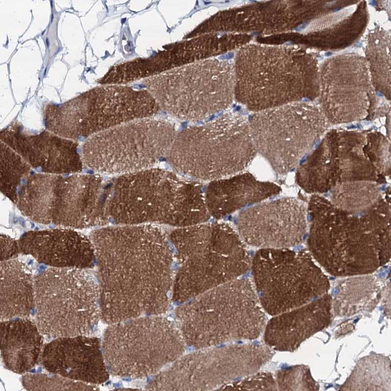 Triadin Antibody - BSA Free Immunohistochemistry-Paraffin: Triadin Antibody [NBP1-87417]