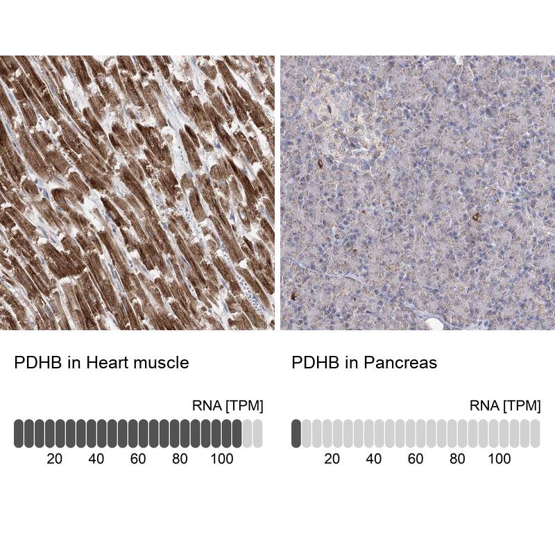 Pyruvate Dehydrogenase E1 beta subunit Antibody - BSA Free Immunohistochemistry-Paraffin: Pyruvate Dehydrogenase E1 beta subunit Antibody [NBP1-87421]