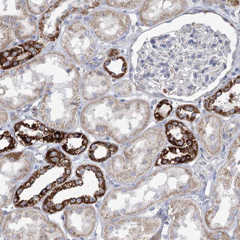 Pyruvate Dehydrogenase E1 beta subunit Antibody - BSA Free Immunohistochemistry-Paraffin: Pyruvate Dehydrogenase E1 beta subunit Antibody [NBP1-87421]