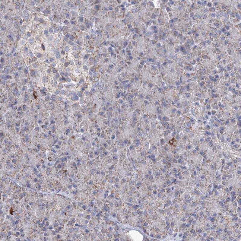 Pyruvate Dehydrogenase E1 beta subunit Antibody - BSA Free Immunohistochemistry-Paraffin: Pyruvate Dehydrogenase E1 beta subunit Antibody [NBP1-87421]