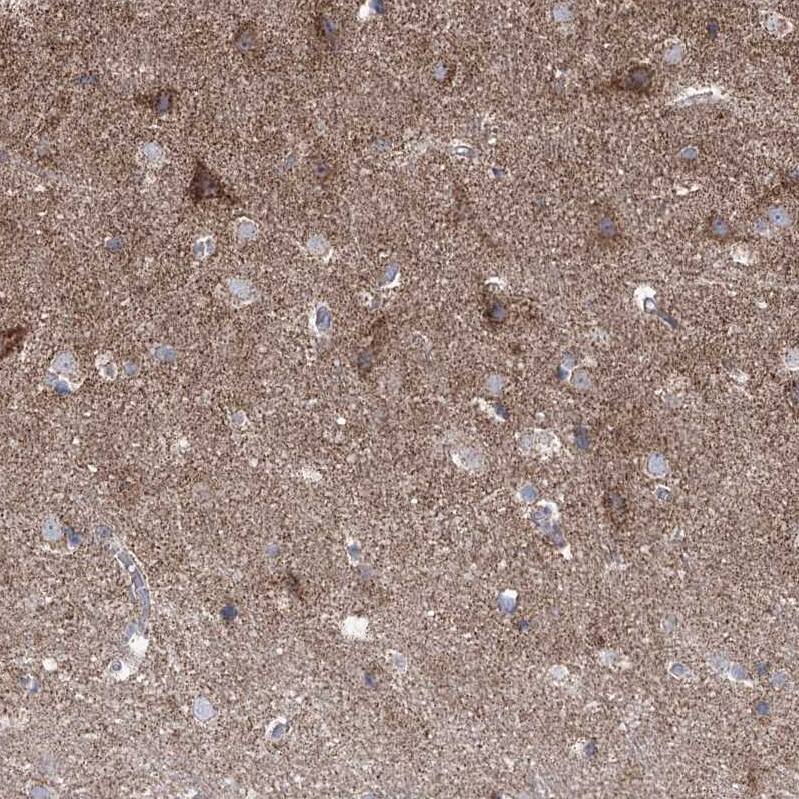 Pyruvate Dehydrogenase E1 beta subunit Antibody - BSA Free Immunohistochemistry-Paraffin: Pyruvate Dehydrogenase E1 beta subunit Antibody [NBP1-87421]