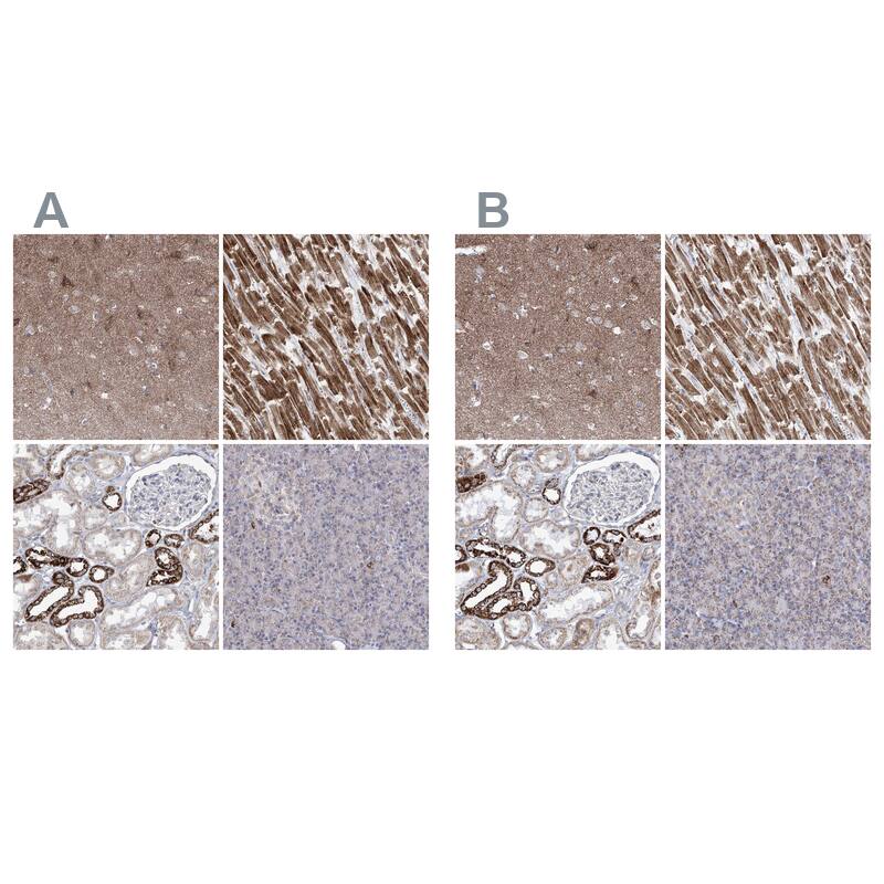 Pyruvate Dehydrogenase E1 beta subunit Antibody - BSA Free Immunohistochemistry-Paraffin: Pyruvate Dehydrogenase E1 beta subunit Antibody [NBP1-87421]