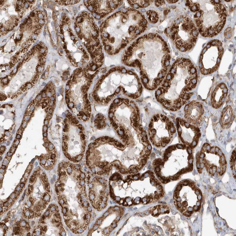 Methylmalonyl Coenzyme A mutase Antibody - BSA Free Immunohistochemistry-Paraffin: Methylmalonyl Coenzyme A mutase Antibody [NBP1-87423]