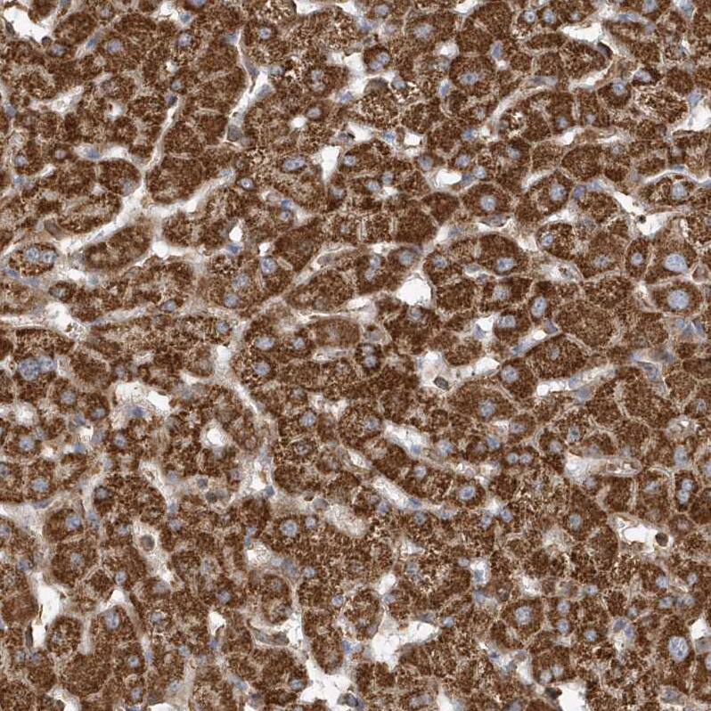 Methylmalonyl Coenzyme A mutase Antibody - BSA Free Immunohistochemistry-Paraffin: Methylmalonyl Coenzyme A mutase Antibody [NBP1-87423]