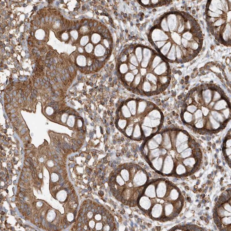 Methylmalonyl Coenzyme A mutase Antibody - BSA Free Immunohistochemistry-Paraffin: Methylmalonyl Coenzyme A mutase Antibody [NBP1-87423]