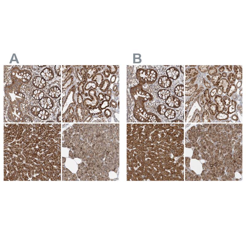 Methylmalonyl Coenzyme A mutase Antibody - BSA Free Immunohistochemistry-Paraffin: Methylmalonyl Coenzyme A mutase Antibody [NBP1-87423]