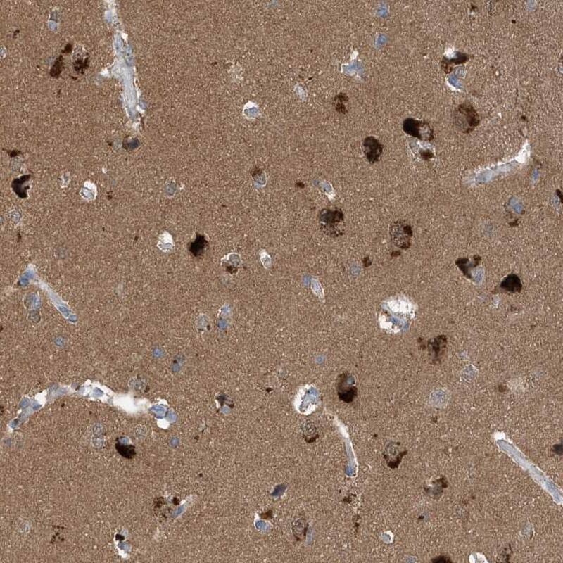 Profilin 2 Antibody - BSA Free Immunohistochemistry-Paraffin: Profilin 2 Antibody [NBP1-87426]