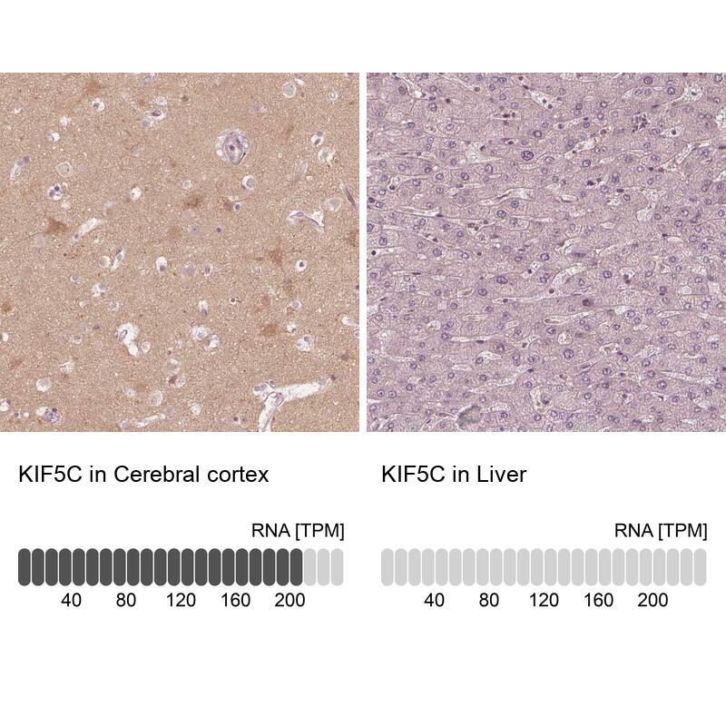 Kinesin 5C Antibody - BSA Free Immunohistochemistry-Paraffin: Kinesin 5C Antibody [NBP1-87429]