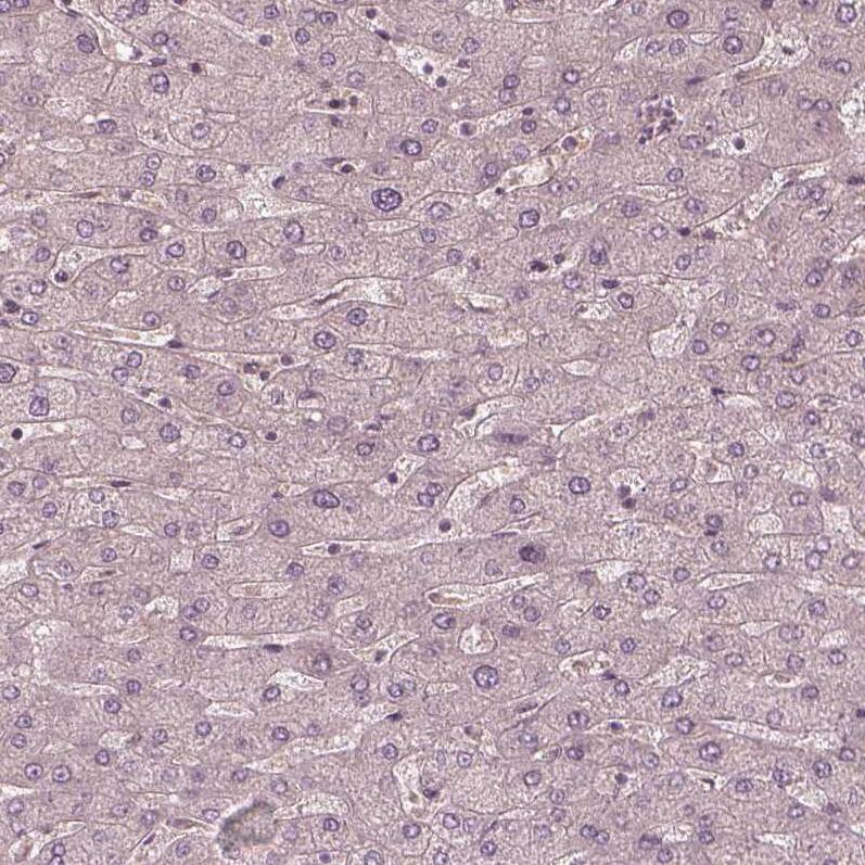 Kinesin 5C Antibody - BSA Free Immunohistochemistry-Paraffin: Kinesin 5C Antibody [NBP1-87429]