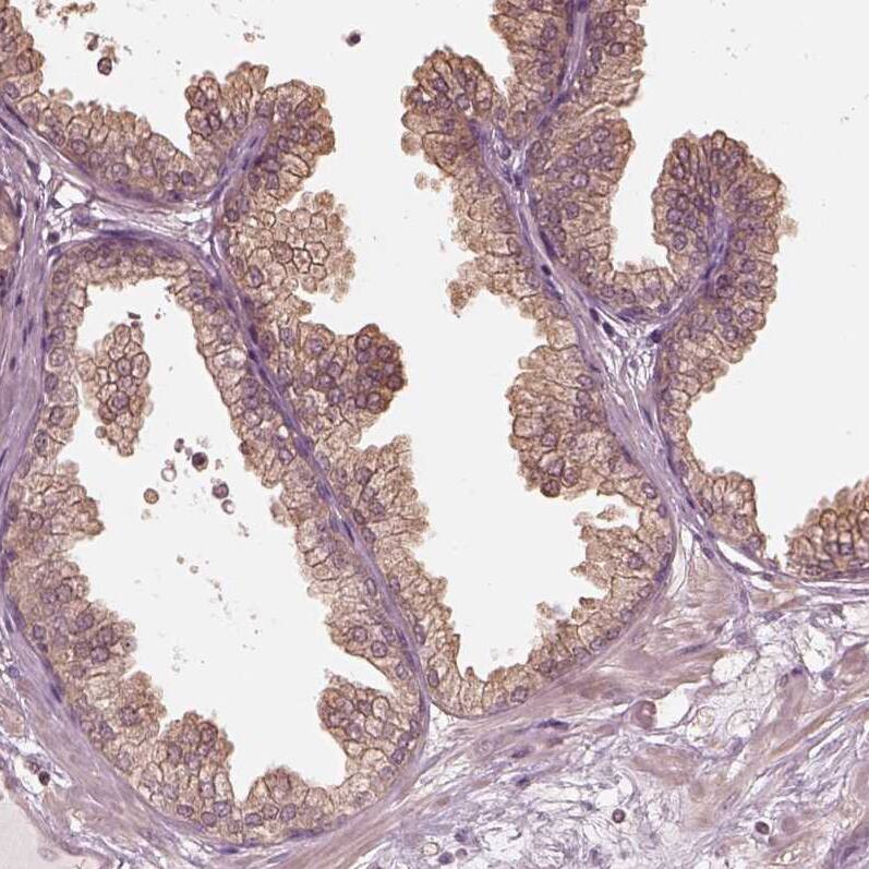 Kinesin 5C Antibody - BSA Free Immunohistochemistry-Paraffin: Kinesin 5C Antibody [NBP1-87429]