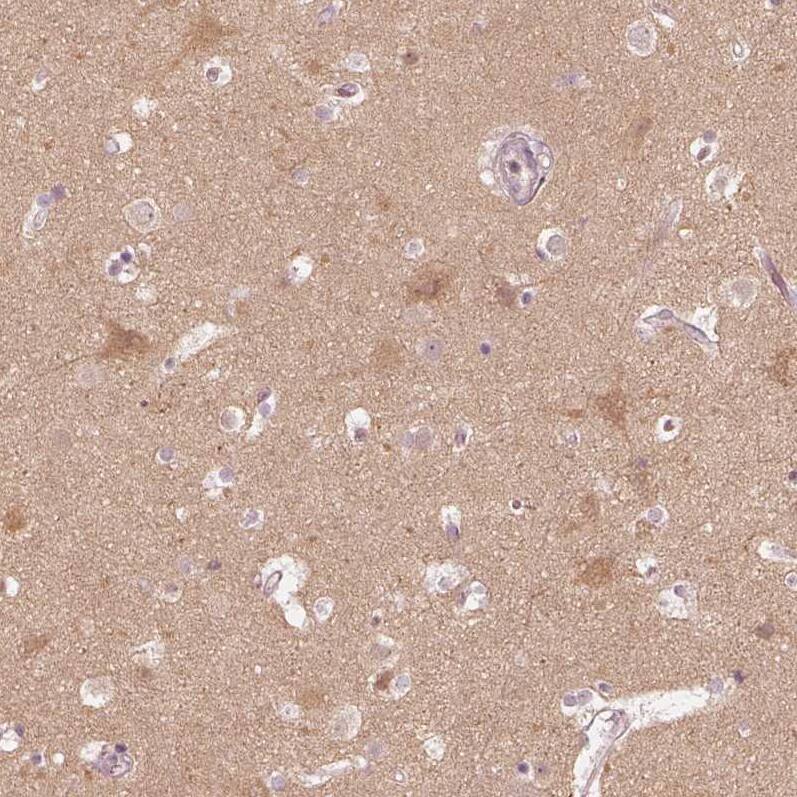 Kinesin 5C Antibody - BSA Free Immunohistochemistry-Paraffin: Kinesin 5C Antibody [NBP1-87429]