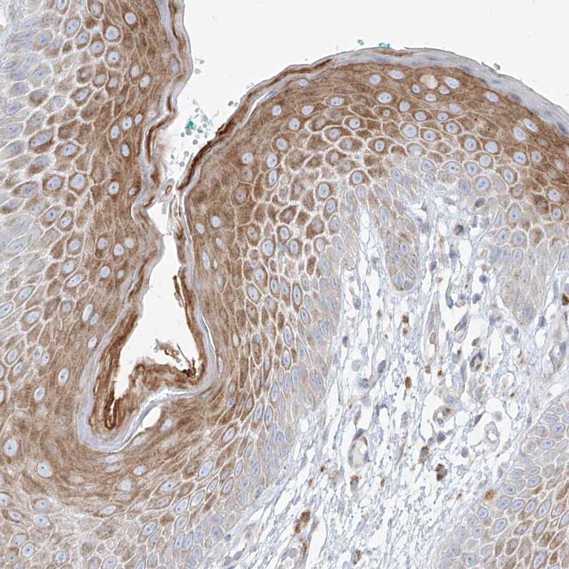 Metaxin-2 Antibody - BSA Free Immunohistochemistry-Paraffin: Metaxin-2 Antibody [NBP1-87436]