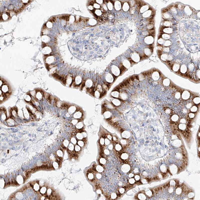 Metaxin-2 Antibody - BSA Free Immunohistochemistry-Paraffin: Metaxin-2 Antibody [NBP1-87436]