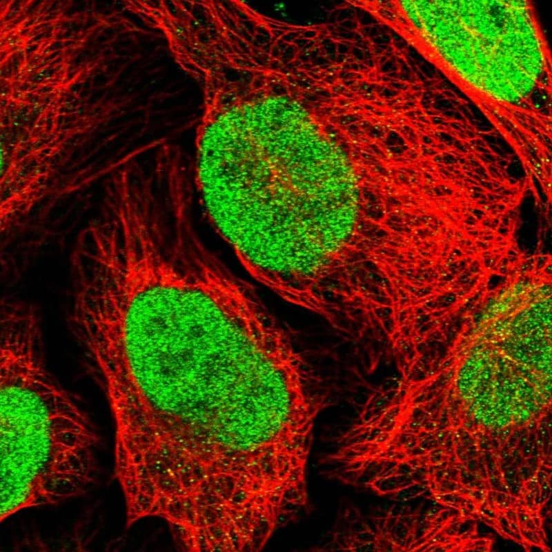 Transketolase Antibody - BSA Free Immunocytochemistry/ Immunofluorescence: Transketolase Antibody [NBP1-87441]