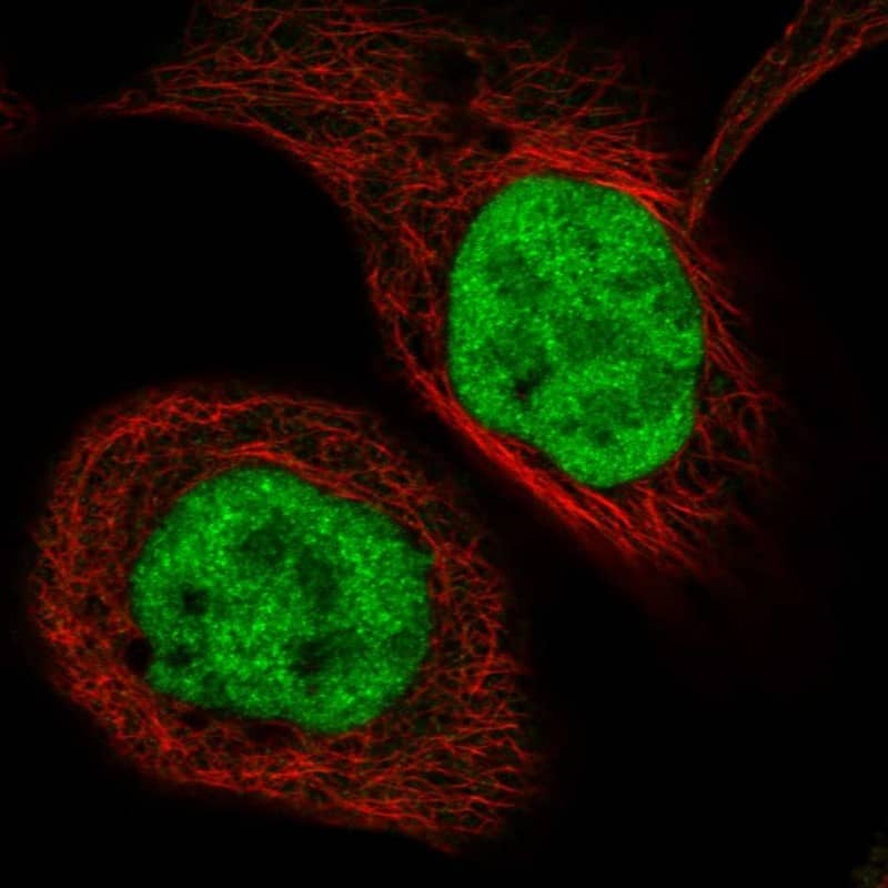 Transketolase Antibody - BSA Free Immunocytochemistry/ Immunofluorescence: Transketolase Antibody [NBP1-87442]