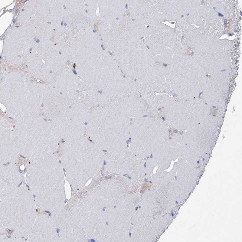 Asparagine synthetase Antibody - BSA Free Immunohistochemistry-Paraffin: Asparagine synthetase Antibody [NBP1-87444]