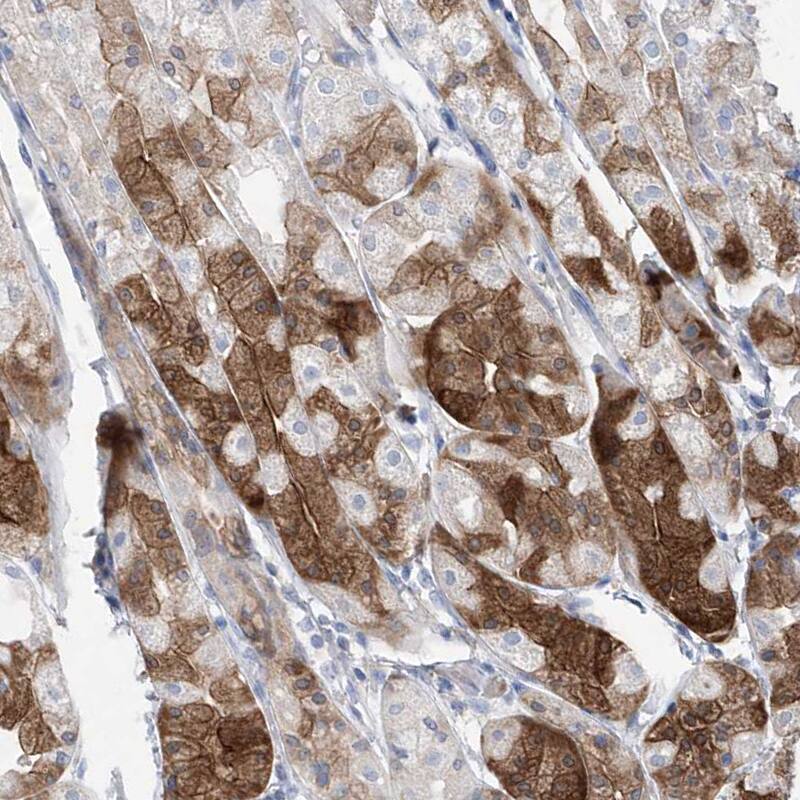 Asparagine synthetase Antibody - BSA Free Immunohistochemistry-Paraffin: Asparagine synthetase Antibody [NBP1-87444]