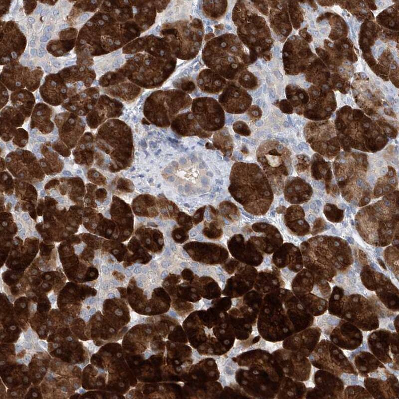 Asparagine synthetase Antibody - BSA Free Immunohistochemistry-Paraffin: Asparagine synthetase Antibody [NBP1-87444]
