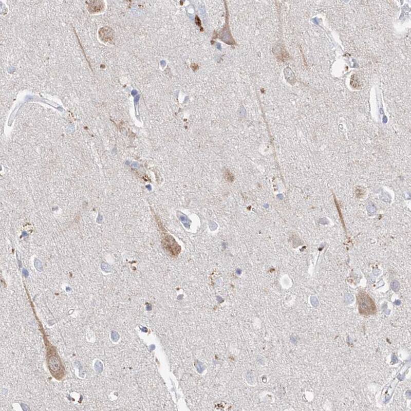 Asparagine synthetase Antibody - BSA Free Immunohistochemistry-Paraffin: Asparagine synthetase Antibody [NBP1-87444]