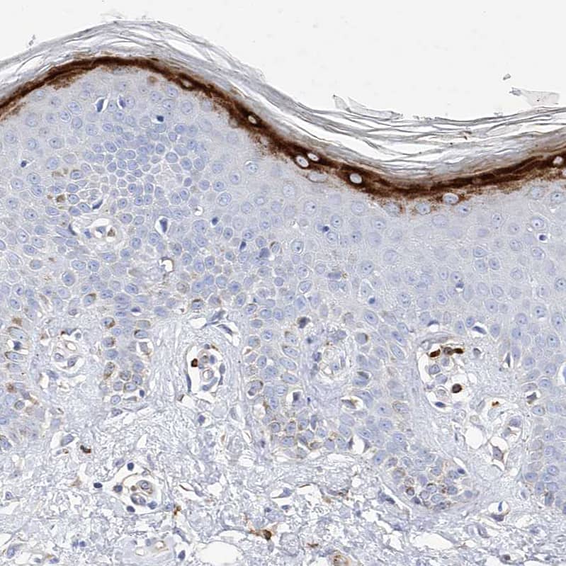 Filaggrin Antibody - BSA Free Immunohistochemistry-Paraffin: Filaggrin Antibody [NBP1-87528]