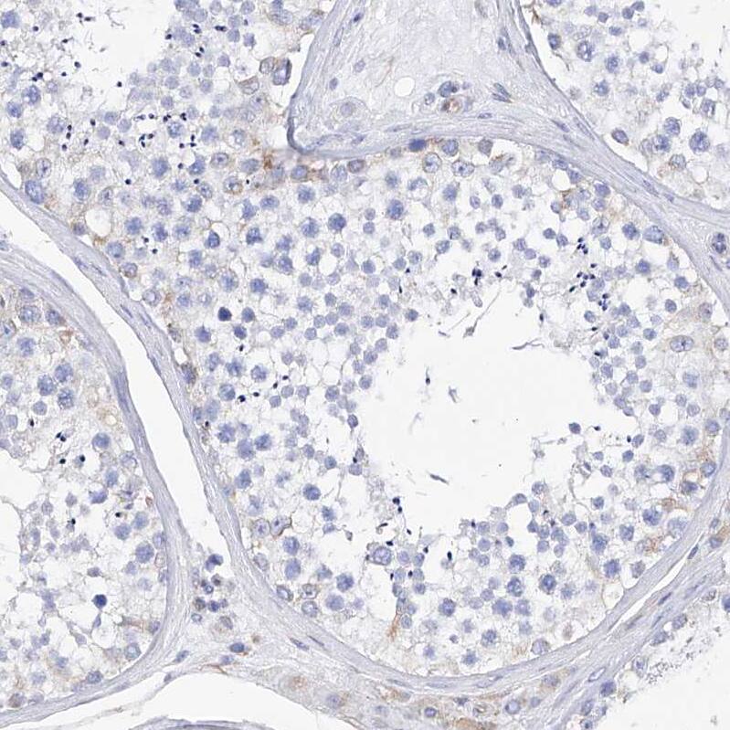 Filaggrin Antibody - BSA Free Immunohistochemistry-Paraffin: Filaggrin Antibody [NBP1-87528]