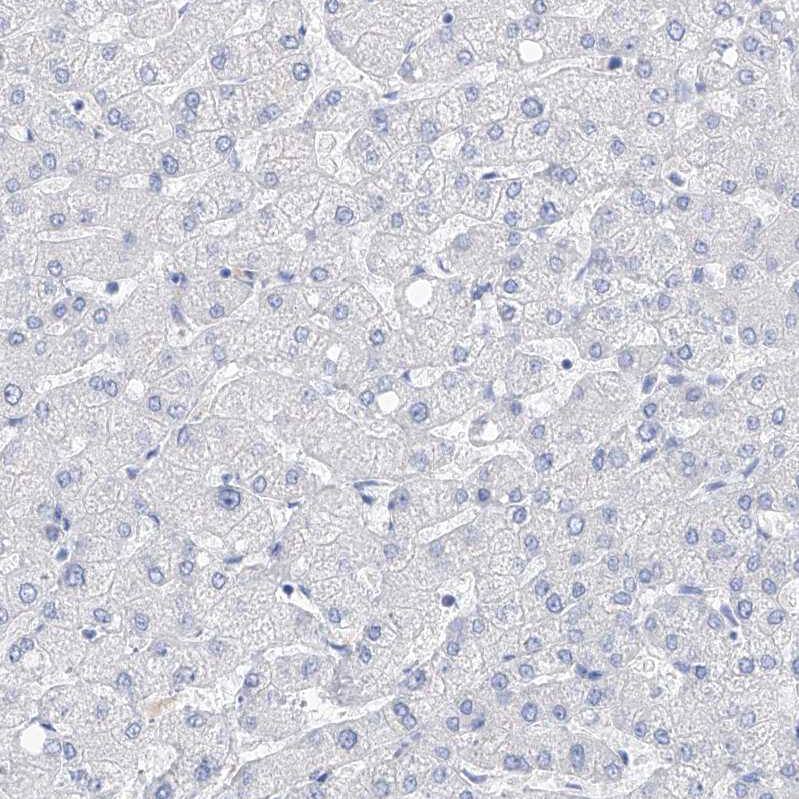 Filaggrin Antibody - BSA Free Immunohistochemistry-Paraffin: Filaggrin Antibody [NBP1-87528]