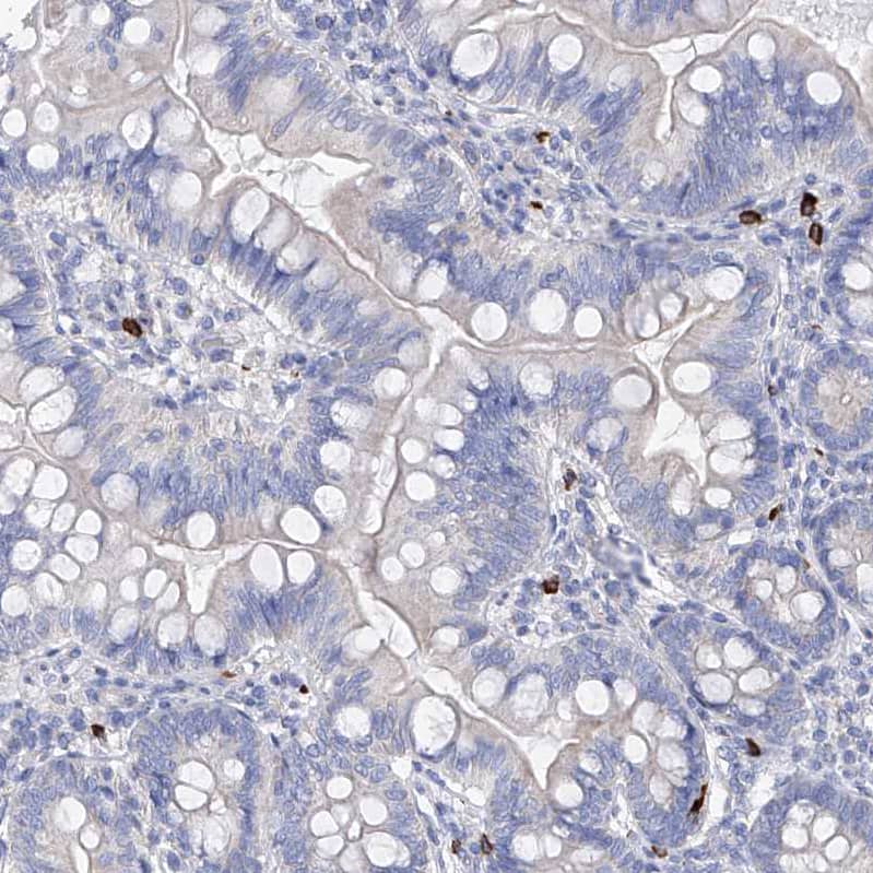 Filaggrin Antibody - BSA Free Immunohistochemistry-Paraffin: Filaggrin Antibody [NBP1-87528]