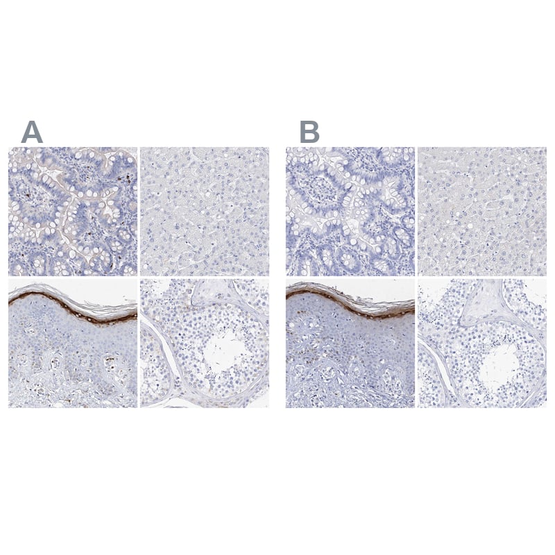 Filaggrin Antibody - BSA Free Immunohistochemistry-Paraffin: Filaggrin Antibody [NBP1-87528]
