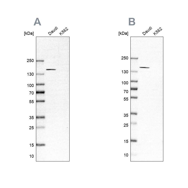 PLC-gamma 2 Antibody Western Blot: PLC-gamma 2 Antibody Antibody [NBP1-87558]