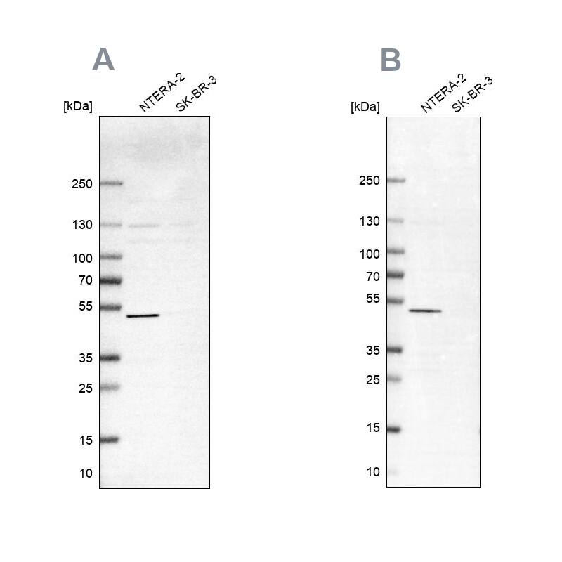 IST1 Antibody Western Blot: IST1 Antibody Antibody [NBP1-87676]