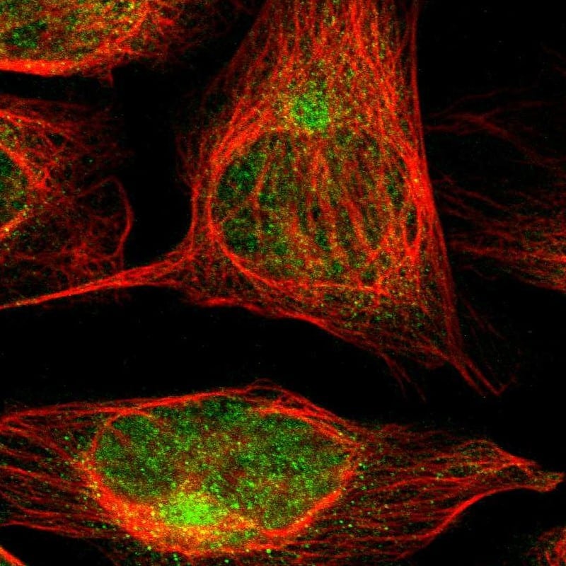 Caspase-6 Antibody Immunocytochemistry/Immunofluorescence: Caspase-6 Antibody [NBP1-87683]
