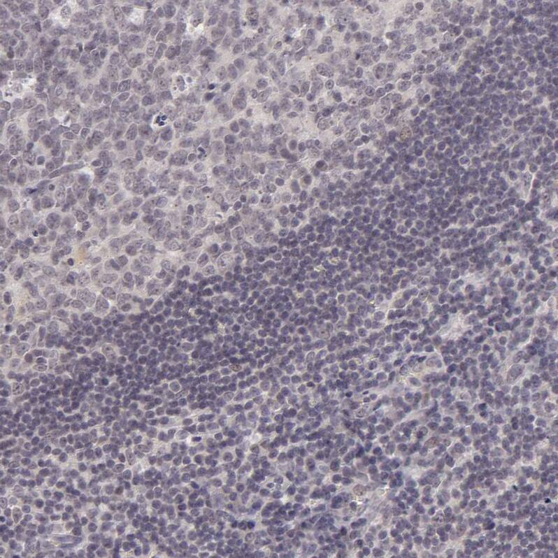 SAP102 Antibody - BSA Free Immunohistochemistry-Paraffin: SAP102 Antibody [NBP1-87691]