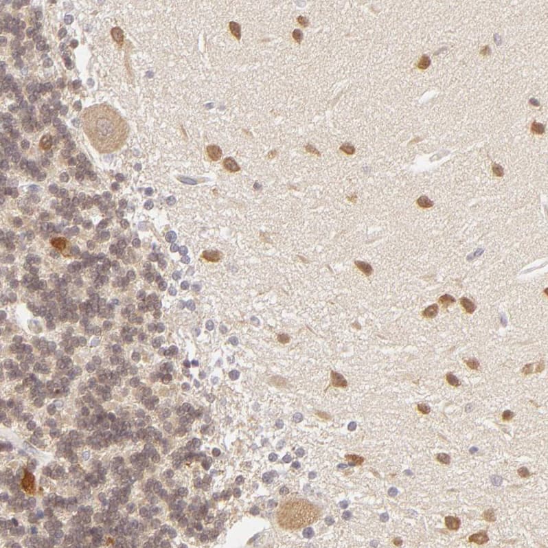 SAP102 Antibody - BSA Free Immunohistochemistry-Paraffin: SAP102 Antibody [NBP1-87691]