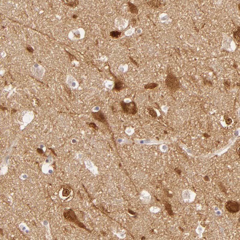 SAP102 Antibody - BSA Free Immunohistochemistry-Paraffin: SAP102 Antibody [NBP1-87691]