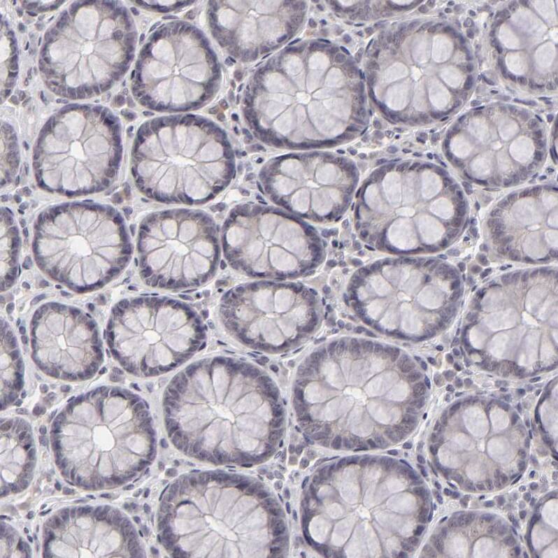 SAP102 Antibody - BSA Free Immunohistochemistry-Paraffin: SAP102 Antibody [NBP1-87691]