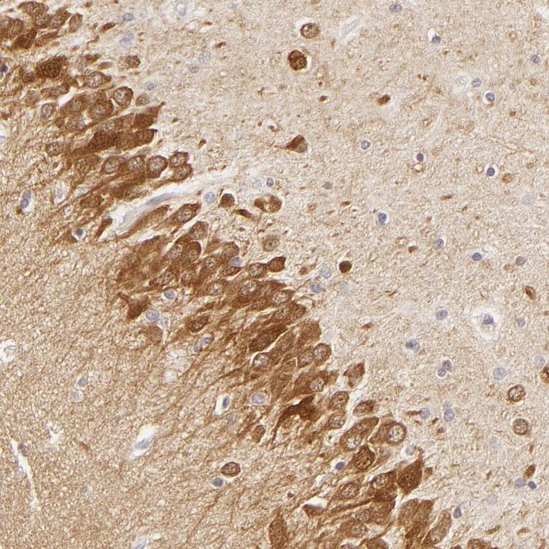 SAP102 Antibody - BSA Free Immunohistochemistry-Paraffin: SAP102 Antibody [NBP1-87691]