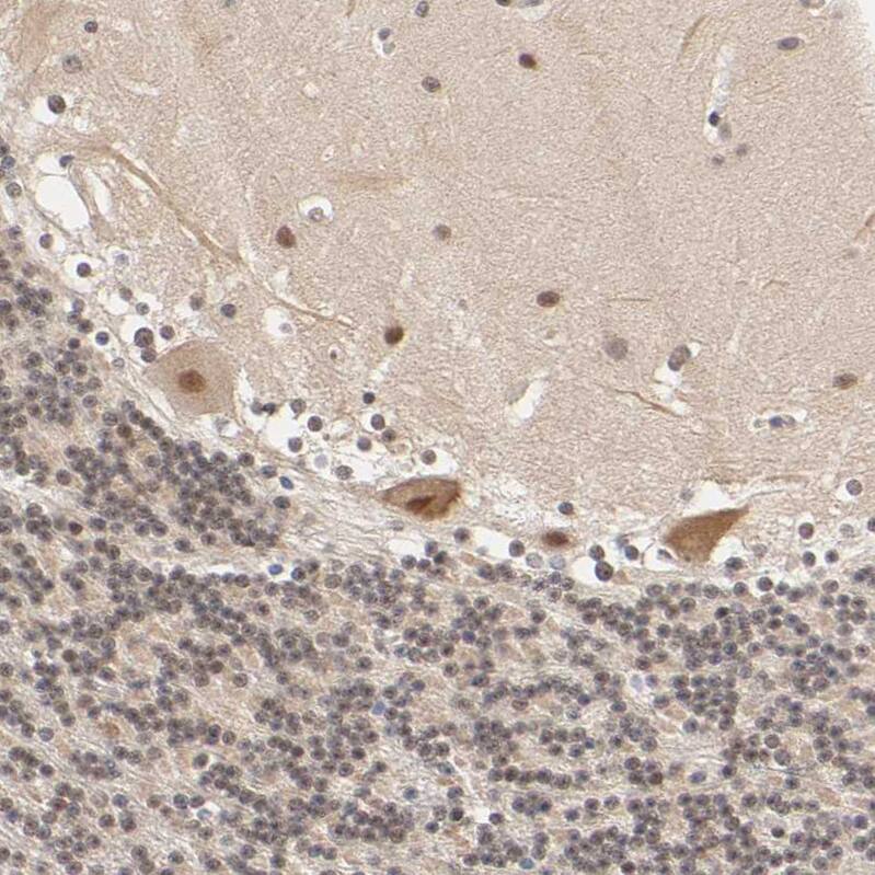 KAT3B/p300 Antibody - BSA Free Immunohistochemistry: KAT3B/p300 Antibody - BSA Free [NBP1-87693]