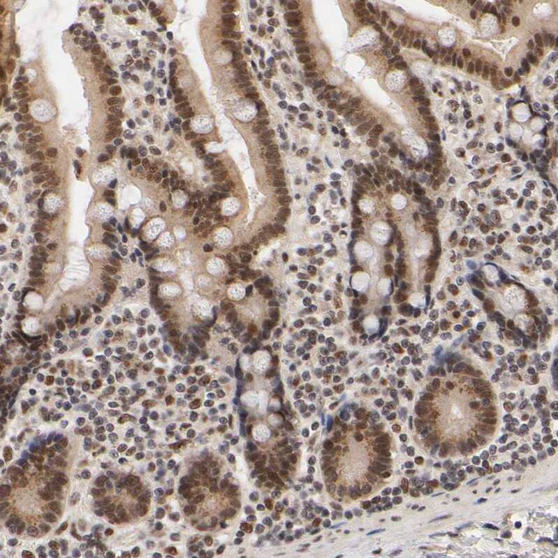 KAT3B/p300 Antibody - BSA Free Immunohistochemistry: KAT3B/p300 Antibody - BSA Free [NBP1-87693]