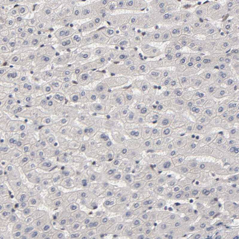 KAT3B/p300 Antibody - BSA Free Immunohistochemistry: KAT3B/p300 Antibody - BSA Free [NBP1-87693]