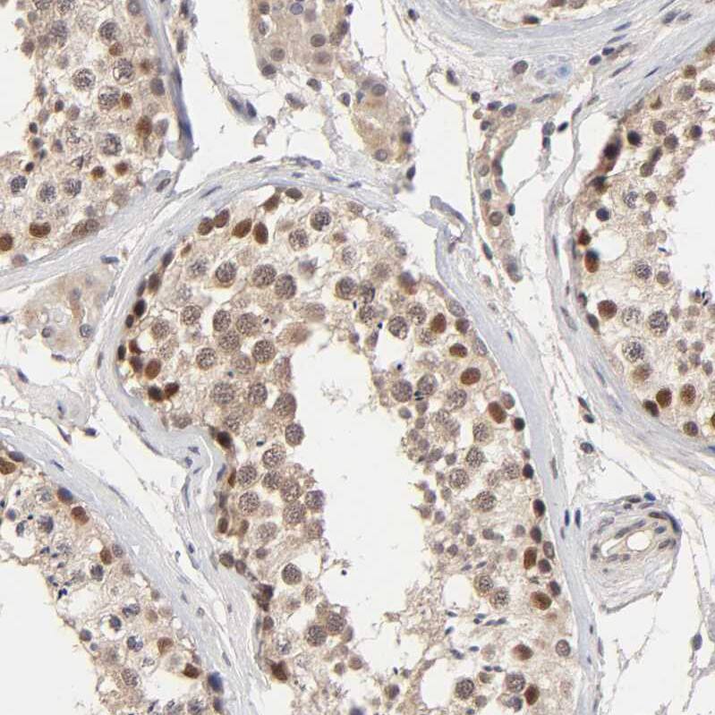 KAT3B/p300 Antibody - BSA Free Immunohistochemistry: KAT3B/p300 Antibody - BSA Free [NBP1-87693]
