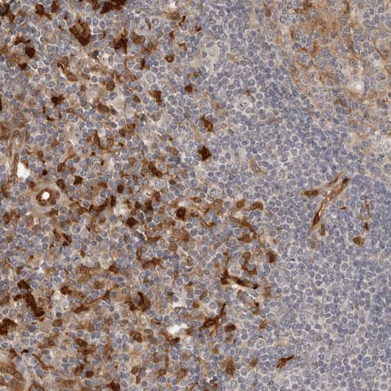 Indoleamine 2,3-dioxygenase/IDO Antibody - BSA Free Immunohistochemistry-Paraffin: Indoleamine 2,3-dioxygenase/IDO Antibody [NBP1-87701]