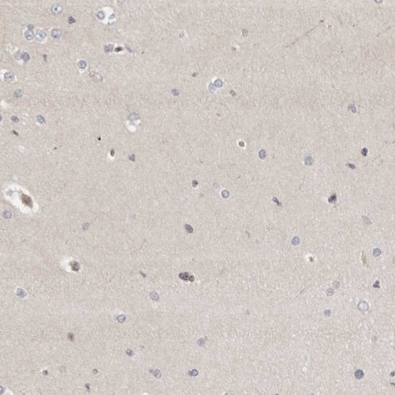 Indoleamine 2,3-dioxygenase/IDO Antibody - BSA Free Immunohistochemistry-Paraffin: Indoleamine 2,3-dioxygenase/IDO Antibody [NBP1-87701]