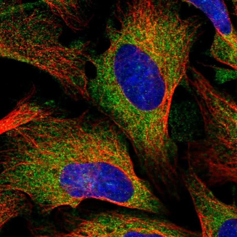 Lysyl tRNA synthetase Antibody - BSA Free Immunocytochemistry/ Immunofluorescence: Lysyl tRNA synthetase Antibody [NBP1-87706]