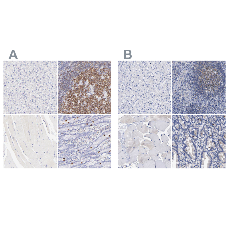LRMP/Jaw1 Antibody Immunohistochemistry-Paraffin: LRMP/Jaw1 Antibody Antibody [NBP1-87724]