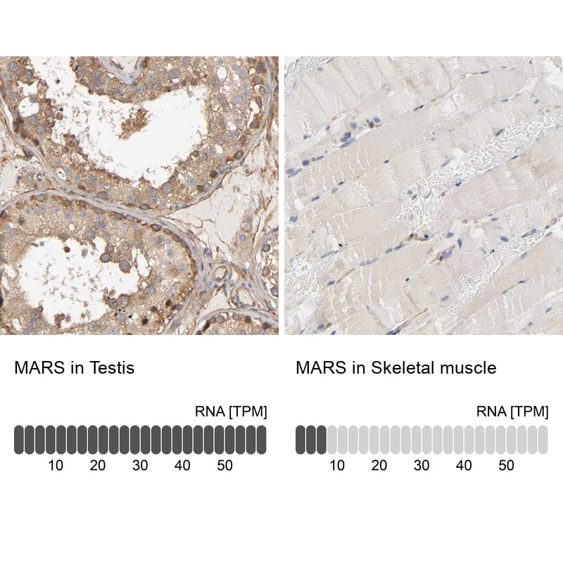 Methionyl tRNA synthetase Antibody - BSA Free Immunohistochemistry-Paraffin: Methionyl tRNA synthetase Antibody [NBP1-87730]