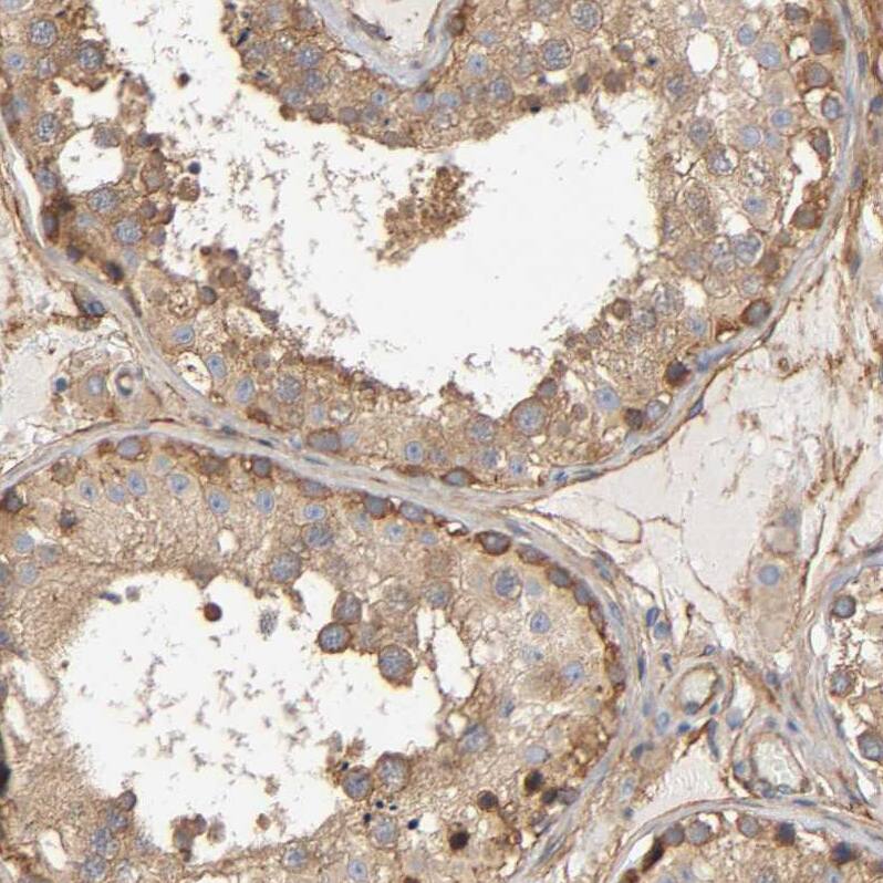 Methionyl tRNA synthetase Antibody - BSA Free Immunohistochemistry-Paraffin: Methionyl tRNA synthetase Antibody [NBP1-87730]
