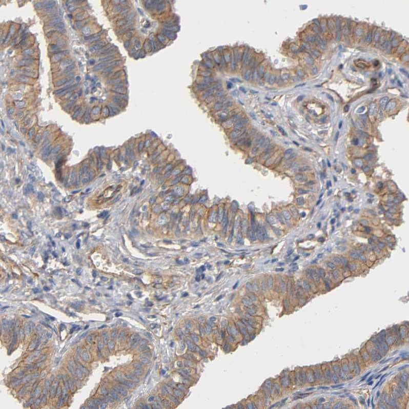 Methionyl tRNA synthetase Antibody - BSA Free Immunohistochemistry-Paraffin: Methionyl tRNA synthetase Antibody [NBP1-87730]