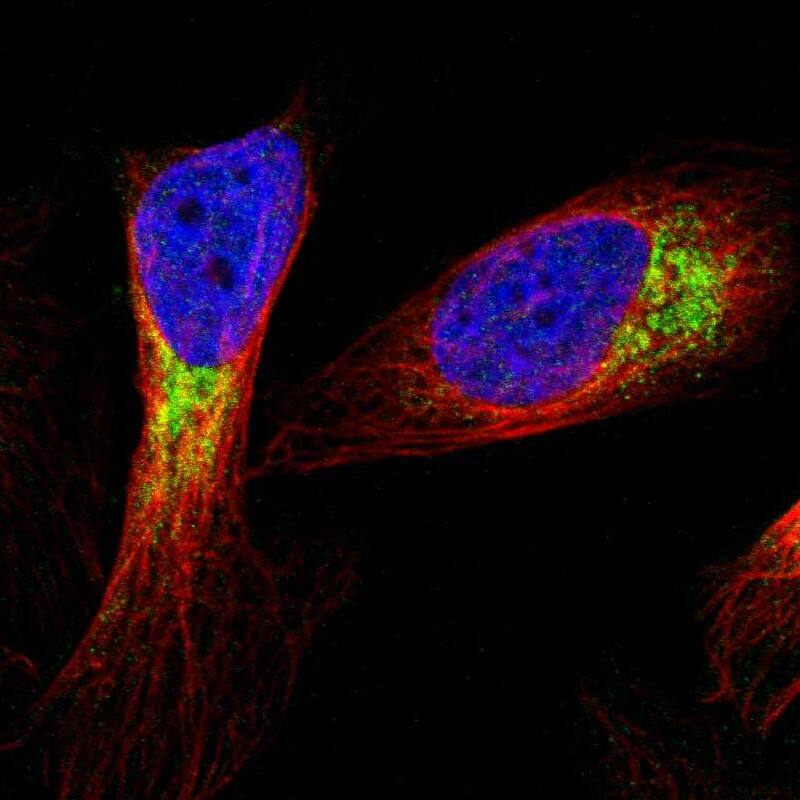 Metaxin 1 Antibody - BSA Free Immunocytochemistry/ Immunofluorescence: Metaxin 1 Antibody [NBP1-87741]
