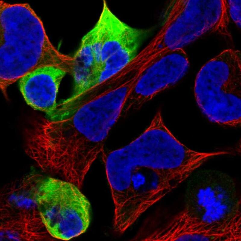 NF-M Antibody - BSA Free Immunocytochemistry/ Immunofluorescence: NF-M Antibody [NBP1-87753]